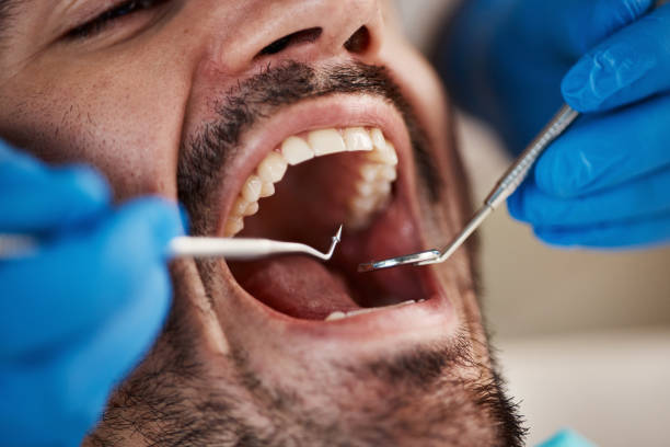 Best Knocked-Out Tooth Emergency  in Darlington, SC